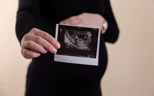 Pregnant woman holding an ultrasound picture representing due date accuracy